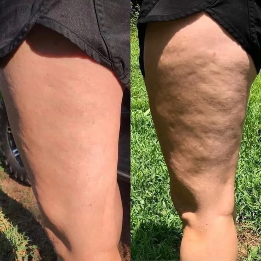 NuSkin ageLOC Dermatic Effects Firming/Cellulite Lotion - Picture 4 of 5